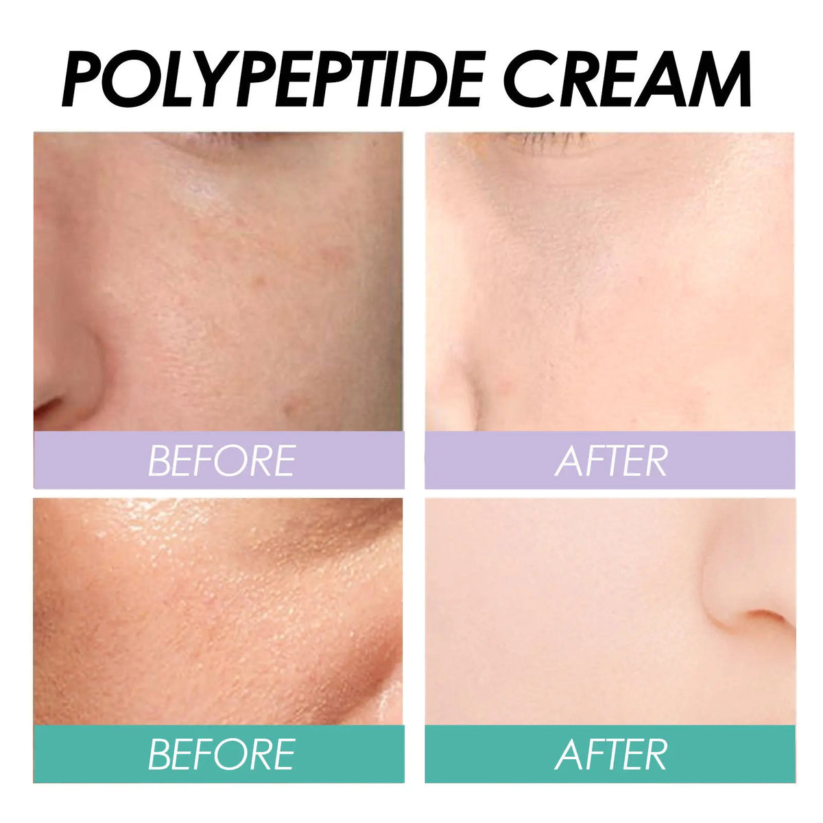 EELHOE Polypeptide Anti-Aging Moisturizer-2